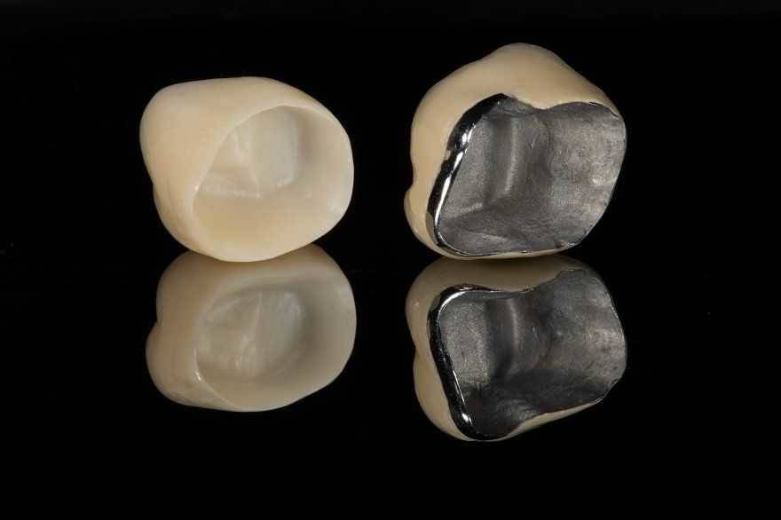 Dental Crown