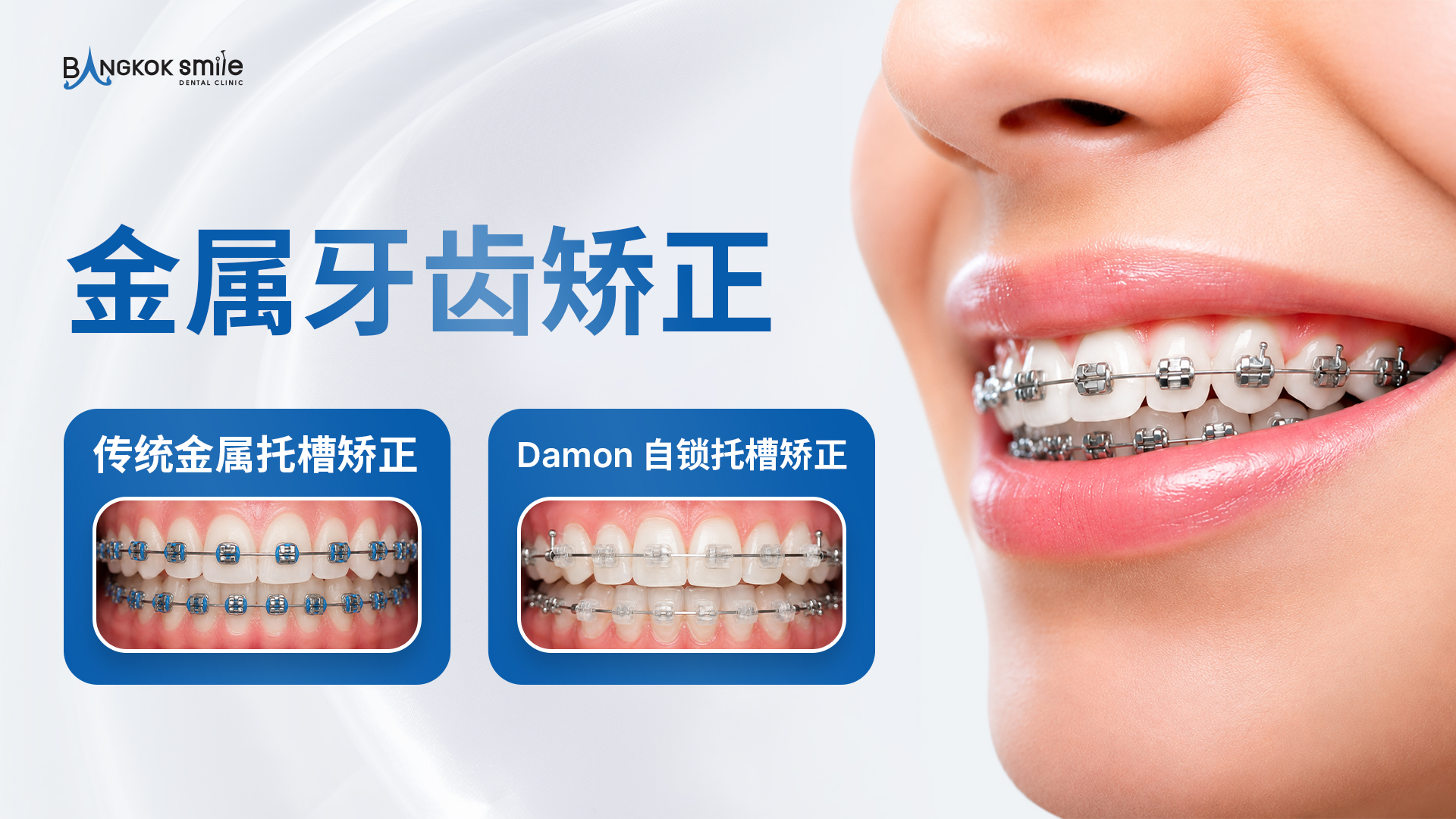 Orthodontic