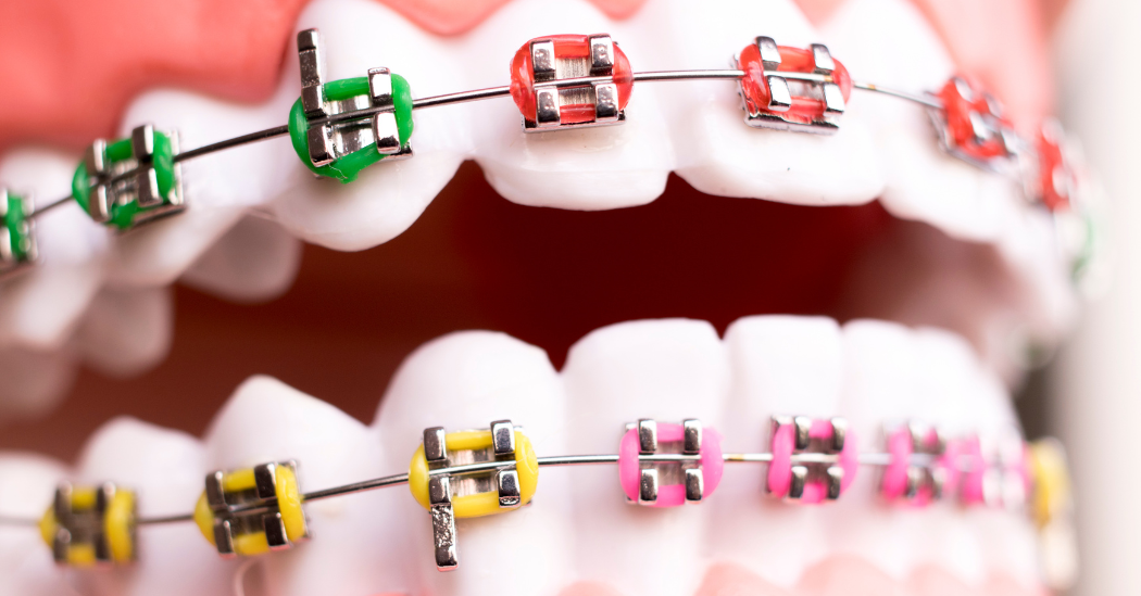 Orthodontic