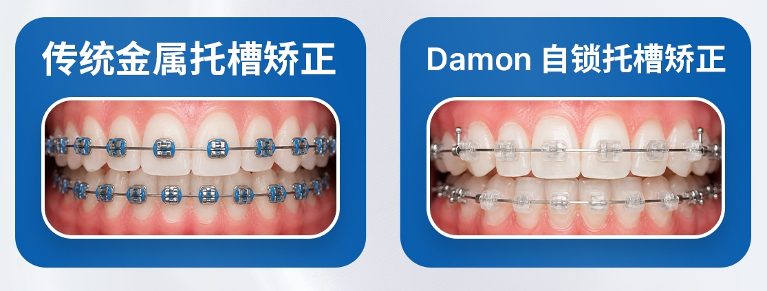 Orthodontic