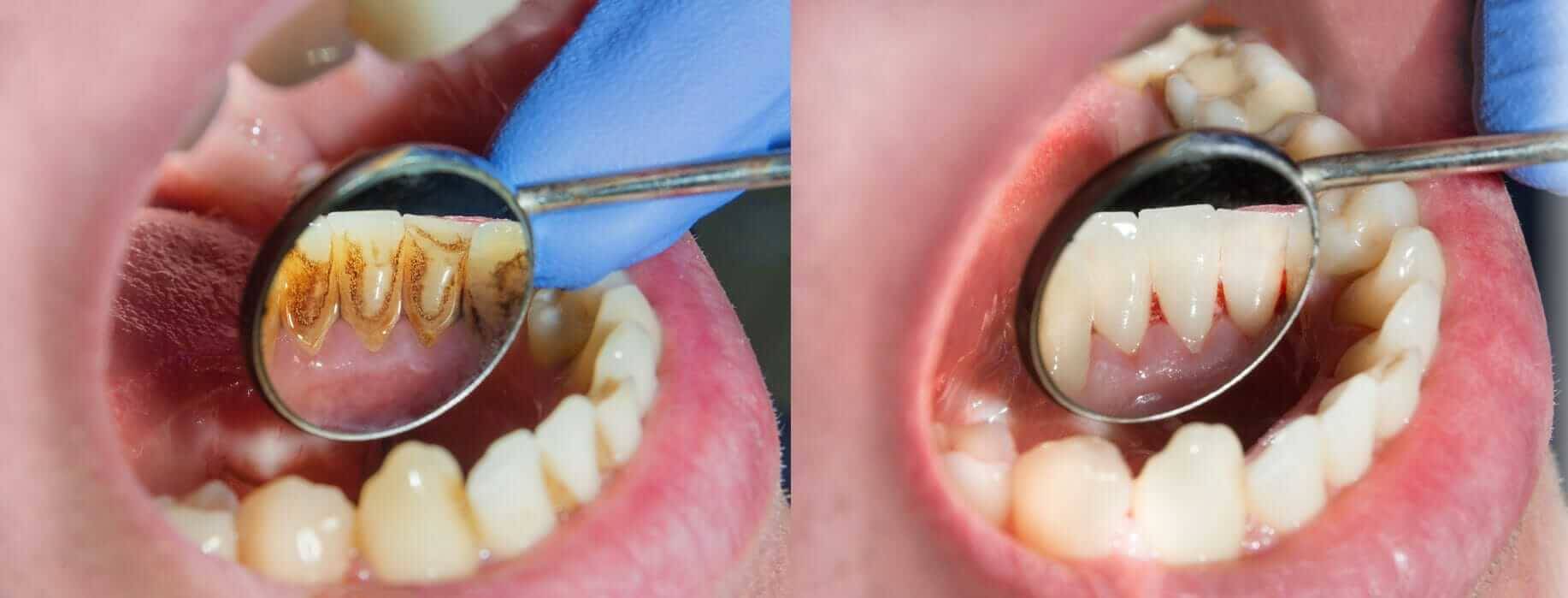 Periodontic